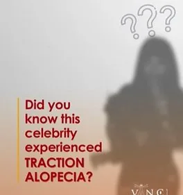 Alopecia awareness creative