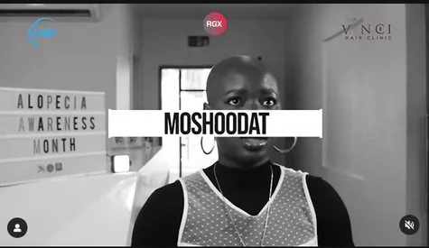 Alopecia story video