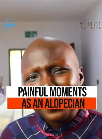 Painful moments as an alopecian video